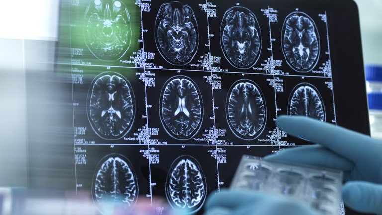 Scientist preparing a multi well plate in front of brain scans