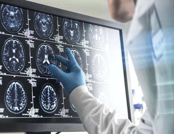 Brain scan images displayed on a touchscreen.