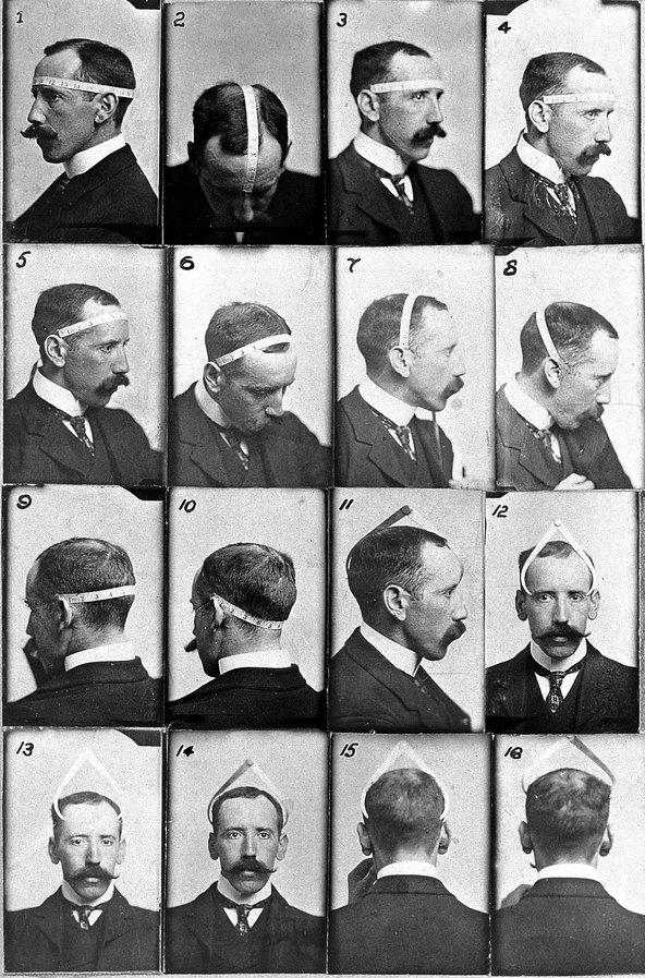 A black and white image of phrenologist, Bernard Hollander illustrating with his own head his system of cranial measurements.